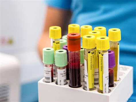 10 Important Blood Tests: What They Show, Why .